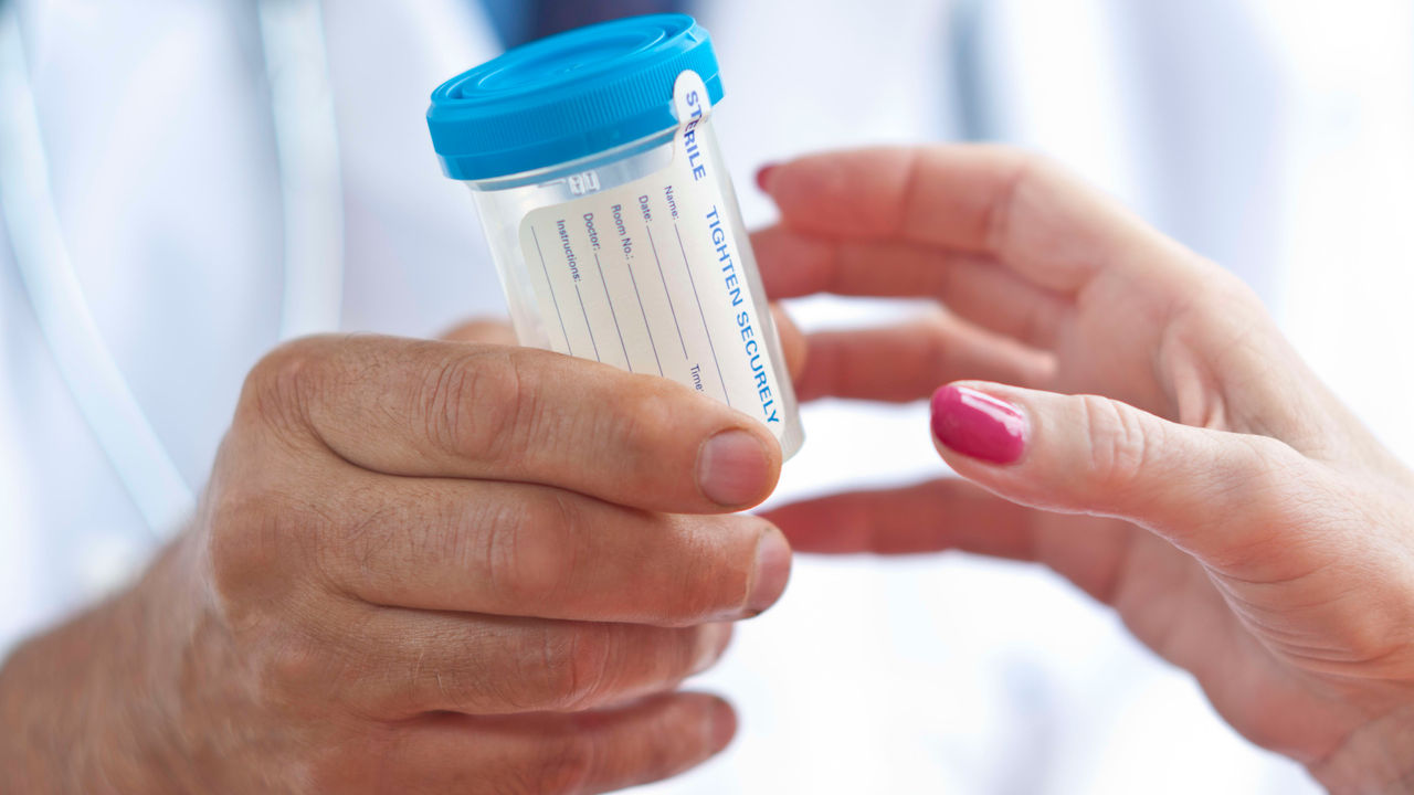 A doctor's hand holding a medicine bottle.